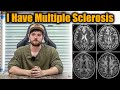 So, I Have Multiple Sclerosis (MS)