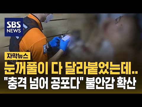 눈꺼풀이 다 달라붙었는데…&amp;quot;충격 넘어 공포다&amp;quot; 불안감 확산 (자막뉴스) / SBS