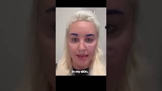 Amanda Bynes reveals she had cosmetic surgery on her eyelids after fans react to ‘new look’ #shorts