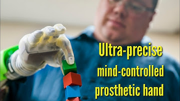 Ultra-precise, mind-controlled prosthetic hand makes amputees feel like they get hand again