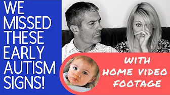 Very Early Autism Signs In Our Baby (5 to 12 months)