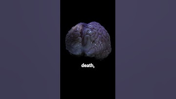 Thumbnail of Your brain still works after death