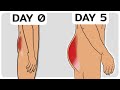 My 5day glute transformation experiment