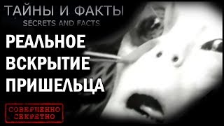 Редкое документальное видео вскрытия Пришельца.......  Смотрите пока не удалили....