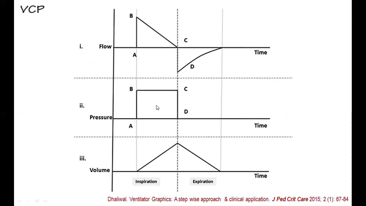 Ventilación mecánica: ¿Cómo interpretar las gráficas? #pediatrics #VM