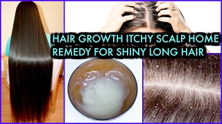 How To Grow Long Hair, treat Itchy Scalp, Get Shiny Hair | SuperPrincessjo