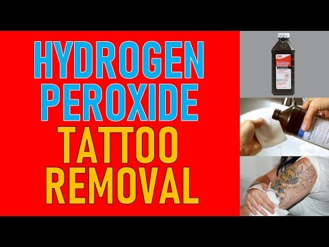 Hydrogen Peroxide Tattoo Removal | Natural Tattoo Removal Methods