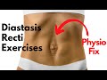 How to START Diastasis Recti Exercises that FIX YOUR GAP | PHYSIO GUIDED Abdo Separation Repair