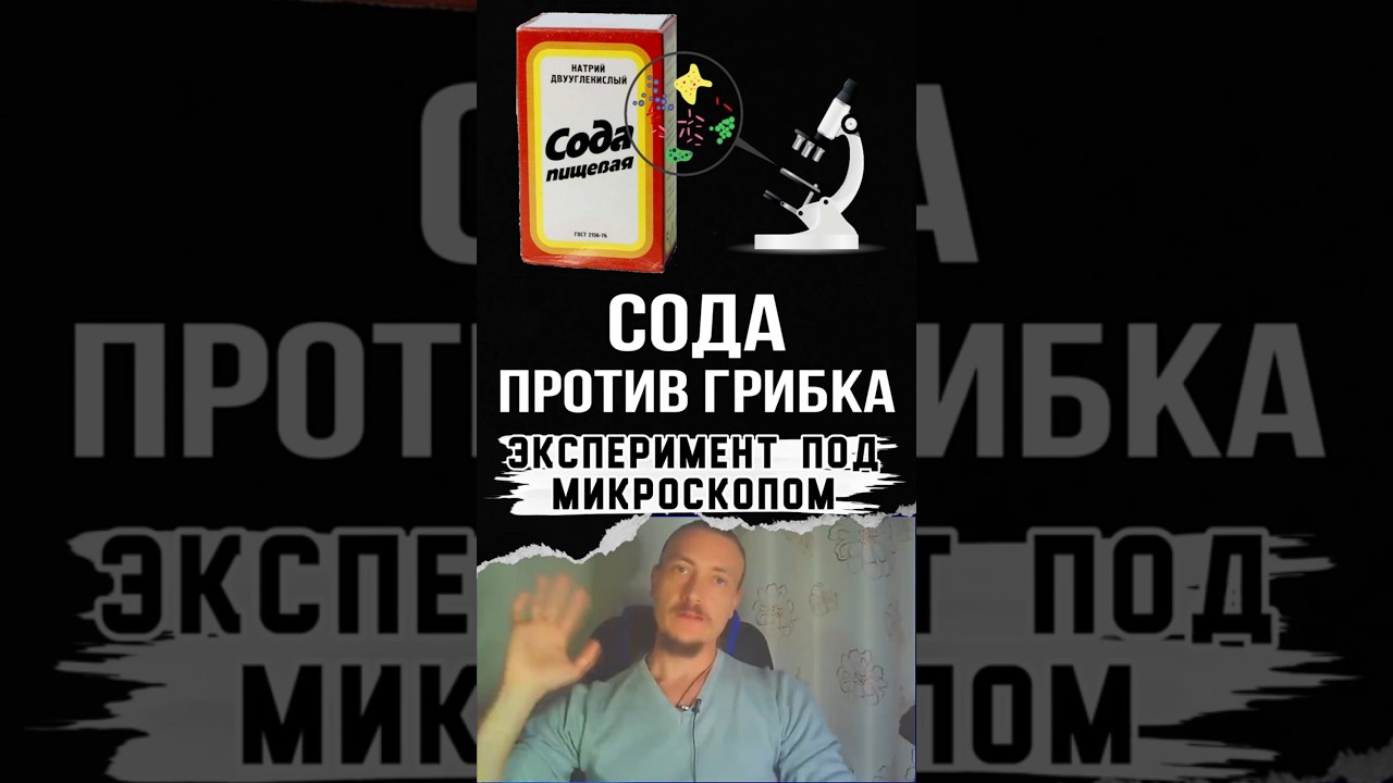 Как сода борется с грибком в организме #грибок #здоровье #кандида #подмикроскопом