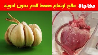 علاج ضغط الدم بدون ادوية طرق طبيعية وأتت بنتائج قوية أراحت كل من جربها والاطعمة المعجزة للحل