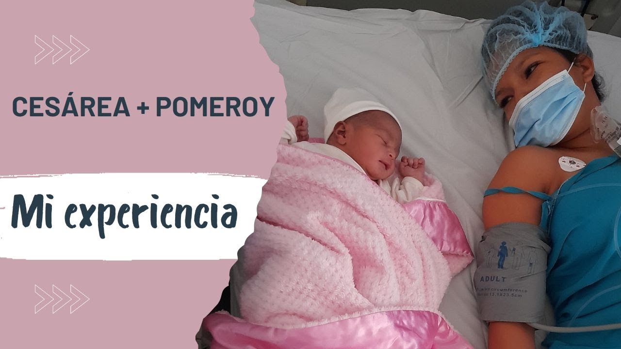 CESÁREA MÁS POMEROY...MI EXPERIENCIA!!! CLINICA LA MERCED 2022 YouTube