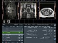 How to MRI of Lower Abdomen Planning...