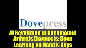 AI Revolution in Rheumatoid Arthritis Diagnosis: Deep Learning on Hand X-Rays