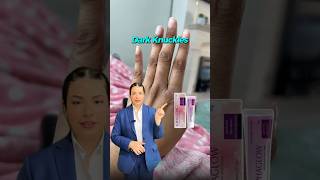 Dark body areas? Totally normal but also treatable. With the right care and consistency #brightskin