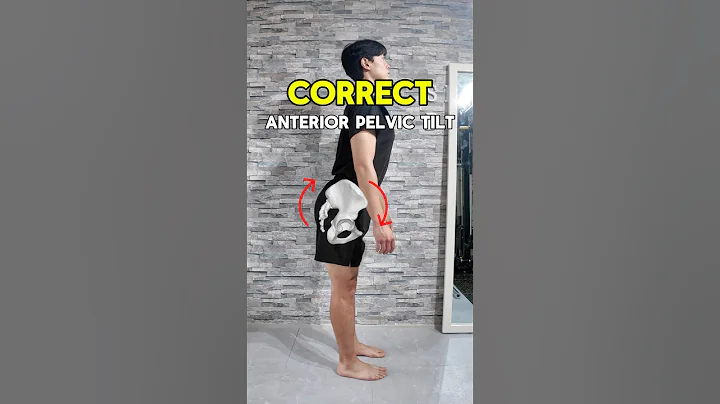 Finally FIx Your Anterior Pelvic Tilt