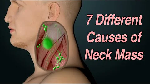 Adult Neck Mass: 7 Different Causes Based on Location - DayDayNews