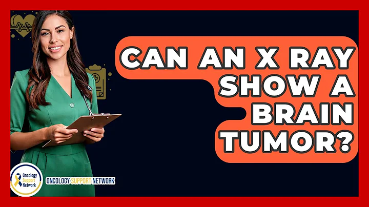 Can An X Ray Show A Brain Tumor? - Oncology Support Network