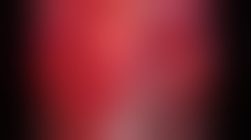 Da Vinci Robotic Radical Prostatectomy