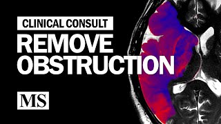 Clinical Consult: Remove The Obstruction