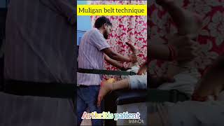 muligan belt technique #youtubeshorts #viral #viralvideo #anatomy #physiotherapy #massage #study