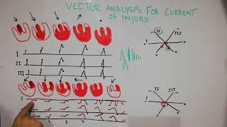 CVS physiology 39. Vectorial analysis for current of injury.