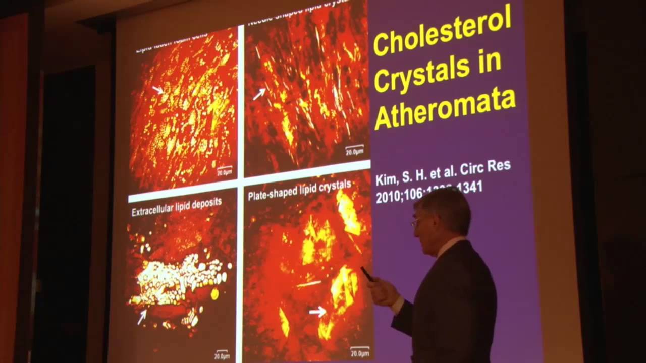 Inflammation in Atherosclerosis, Peter Libby - YouTube