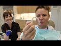 The TRUTH Behind Getting Invisalign!