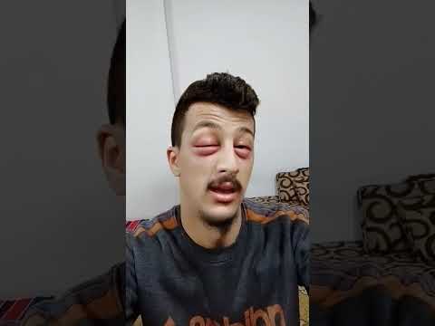 دودي بعتتلي ناس ضربوني تابعو للأخير اكسبلور ضحك كوميديا سوريا     