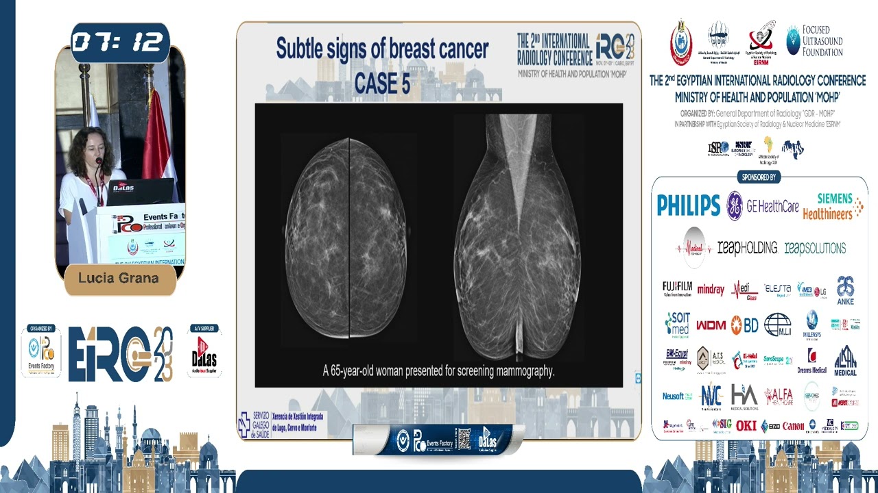 Subtle Signs of Breast Cancer