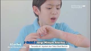 Download lagu Iklan Alerhis