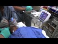 GlideScope Pediatric Airway Rounds Case Study: 4 year old, Cleft Palate Repair