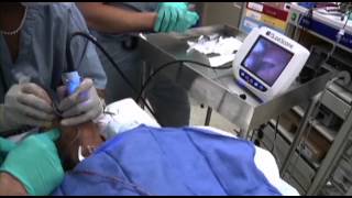 GlideScope Pediatric Airway Rounds Case Study: 4 year old, Cleft Palate Repair