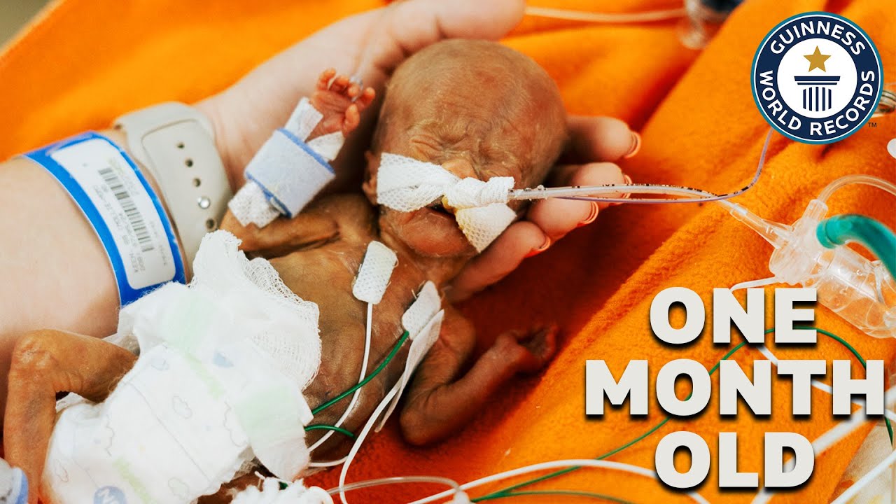 World's Most Premature Baby | Guinness World Records