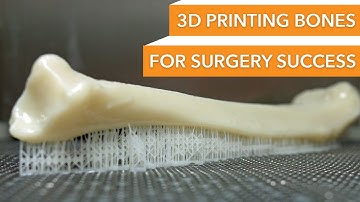 3D Printing Bones for Surgery Success