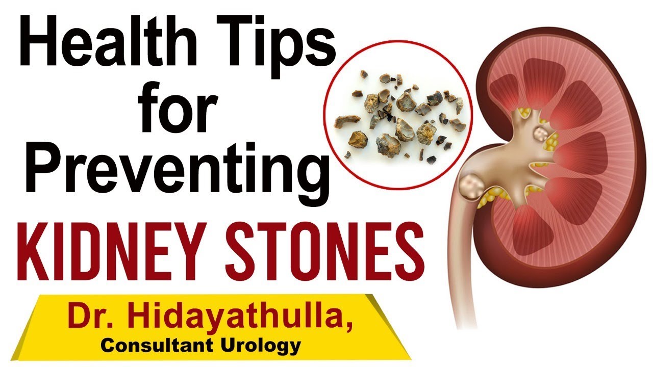 How to Prevent Kidney Stones Top Health Tips Doctor Hidayathulla Full Interview YouTube