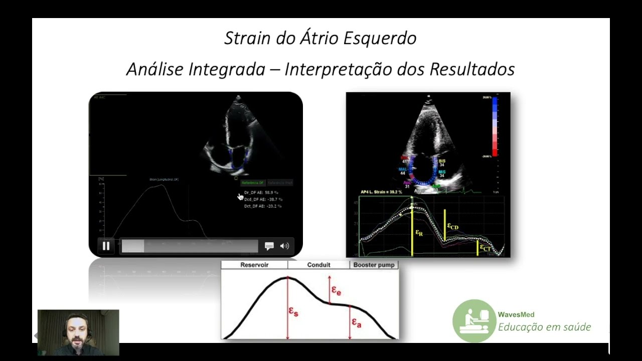 Strain do átrio esquerdo Wavesmed
