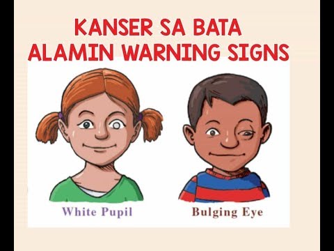 Kanser Sa Bata, Ito ang Warning Signs - Payo ni Doc Liza Ong #286