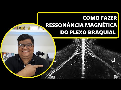 Vídeo: Ressonância magnética mostrará lesão do plexo braquial?
