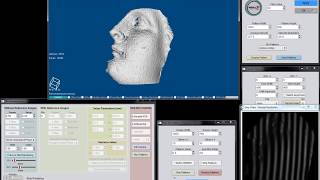 Real-time Structured Light 3D Scanning