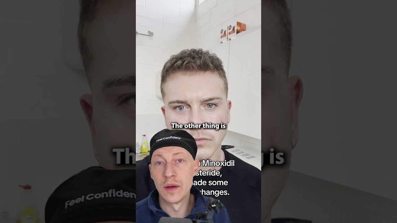 Finasteride & Minoxidil WORK!