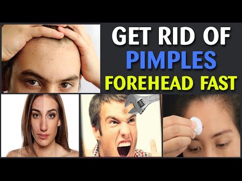 How to Get Rid of Pimples on Forehead Fast | How to Clear Tiny Bumps on Forehead