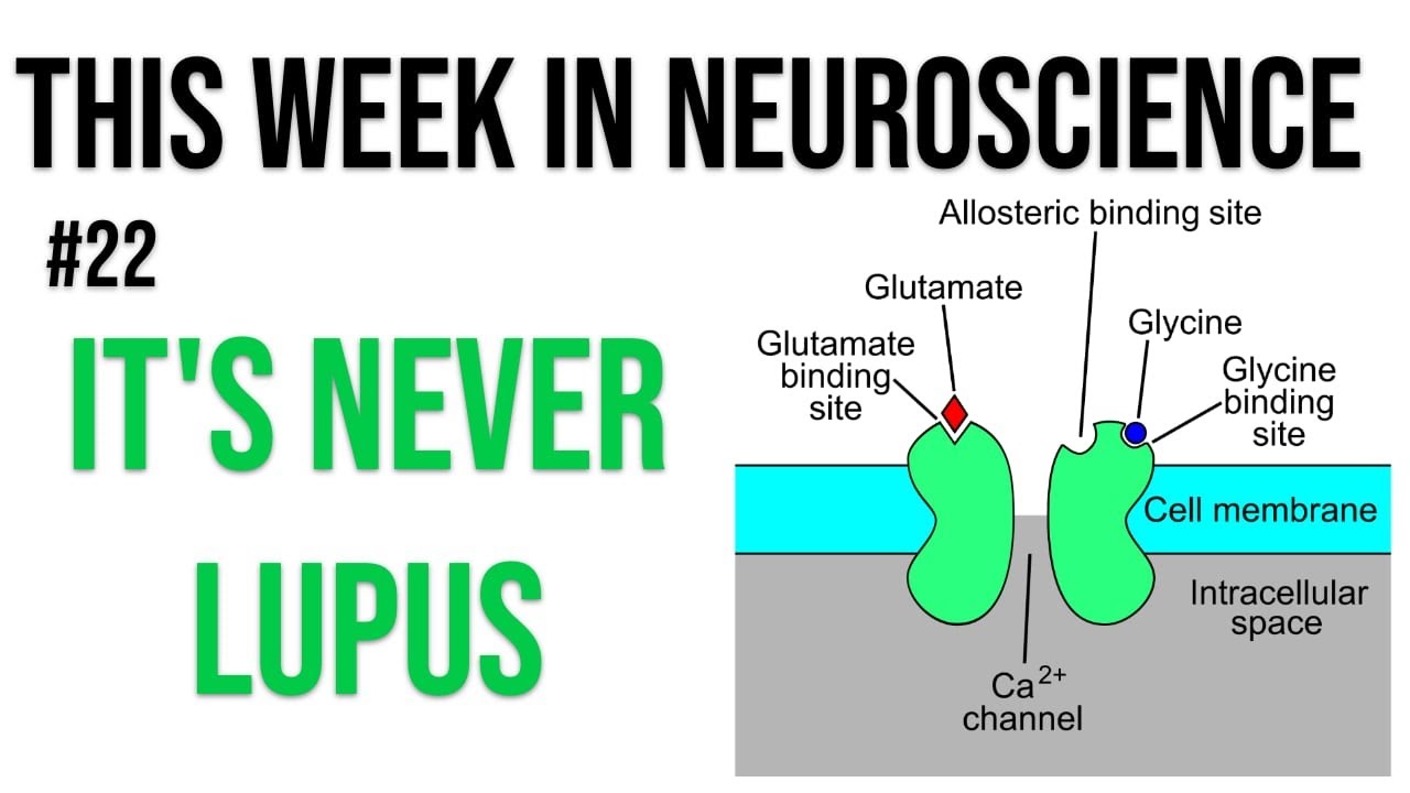 glutathione subcutaneous injection dosage per week Lupus: Symptoms, Causes, Treatment & Management