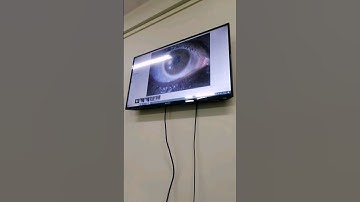 Digital Slit Lamp | Takagi #opthalmology 👁️