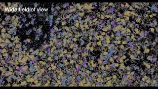 Sub cellular view - Spatial omics