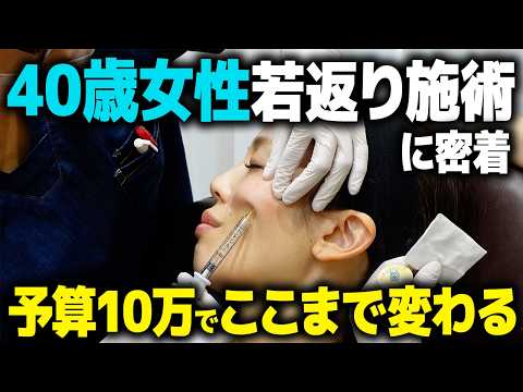 フォトフェイシャルの驚異的な若返り法 : あなたの素肌にはりと潤いを取り戻す! フォトフェイシャルの驚異的な若返り法 あなたの素肌にはりと
