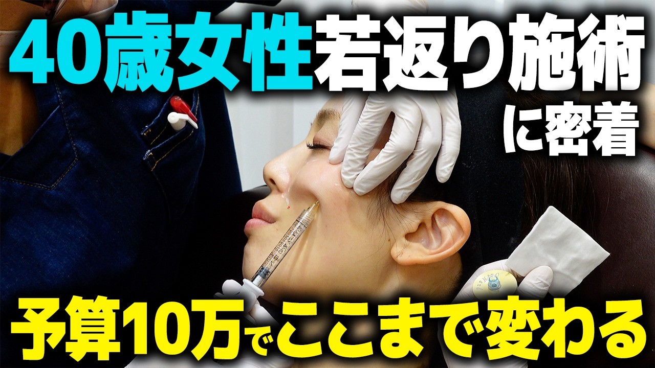 40代女性の予算10万円での若返り治療に密着しました！【アンチエイジング】