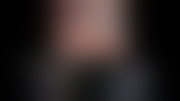 Robotic left lateral living donor hepatectomy | Narrated