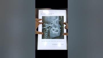 Tracing phim sọ nghiêng - Dr Ngọc Anh