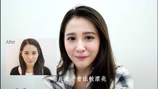 1080926 第五代筋膜層拉提