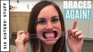 ADULT BRACES vs. INVISALIGN - My Orthodontist Consultation